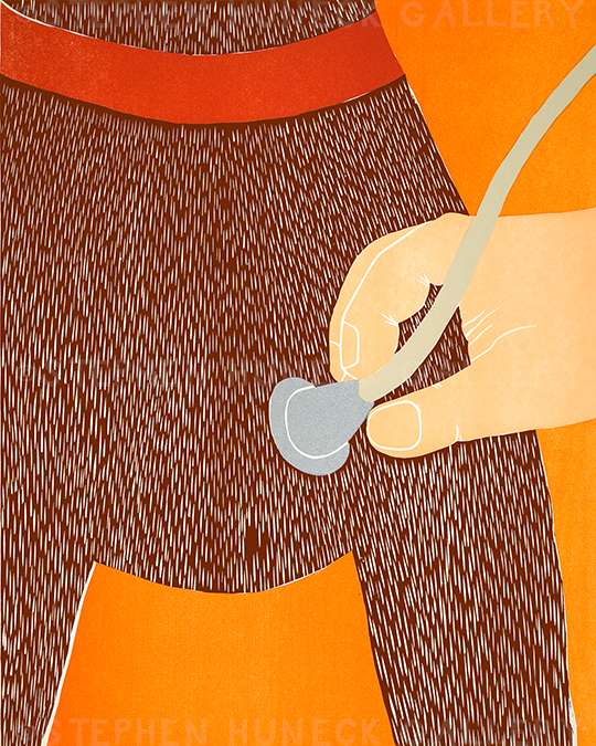 Heart Exam - Original Woodcut