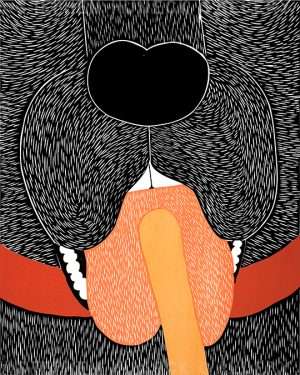 Throat Exam - Original Woodcut