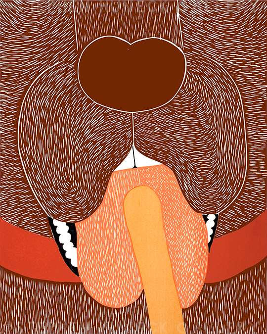 Throat Exam - Original Woodcut