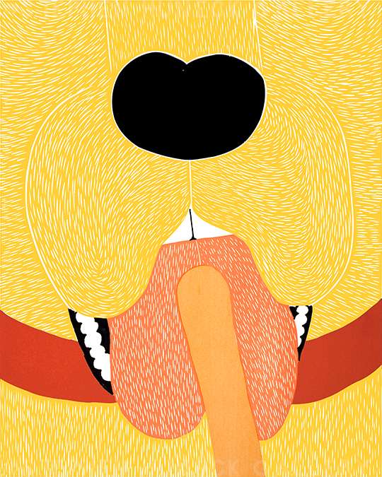 Throat Exam - Original Woodcut